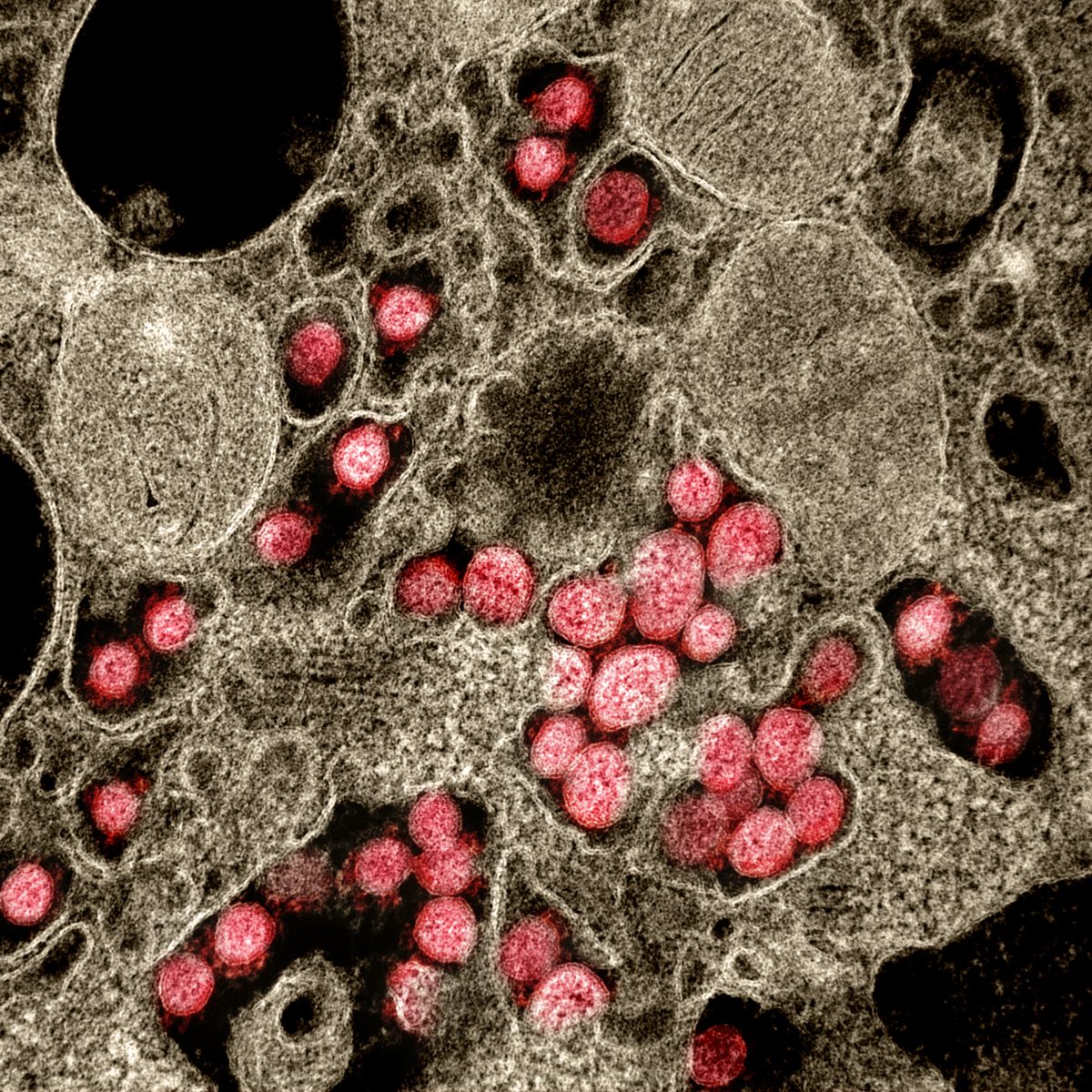 Transmission electron micrograph of SARS-CoV-2 virus particles, isolated from a patient. Image captured and color-enhanced at the NIAID Integrated Research Facility (IRF) in Fort Detrick, Maryland.